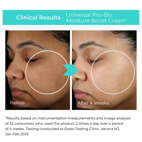 BeautyStat Universal Pro-Bio Moisture Boost Cream $40 - Picture 5 of 10
